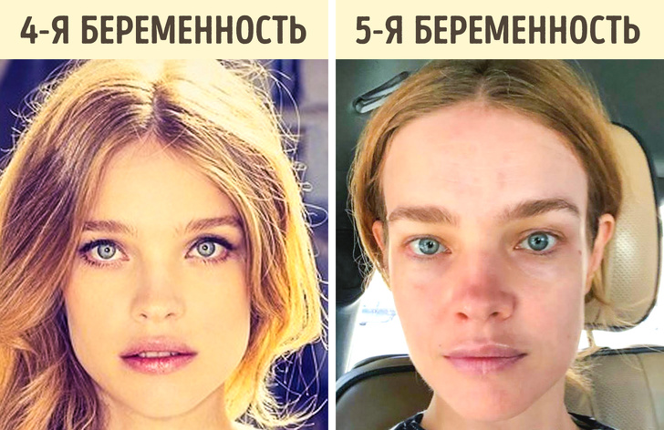 9 странных, но правдивых фактов о беременности