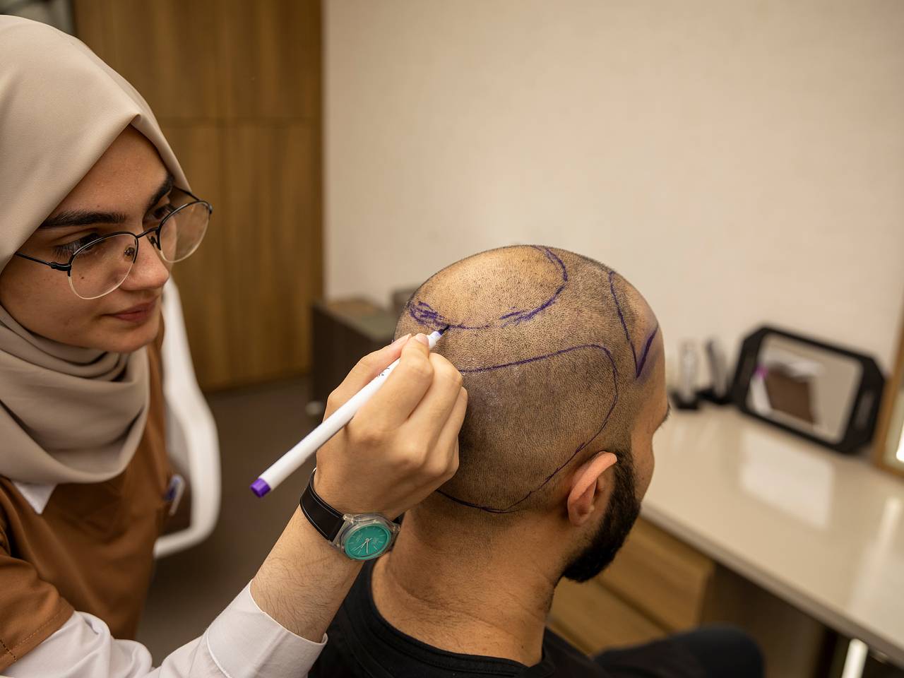 Турист пересадил волосы в Турции и не выжил