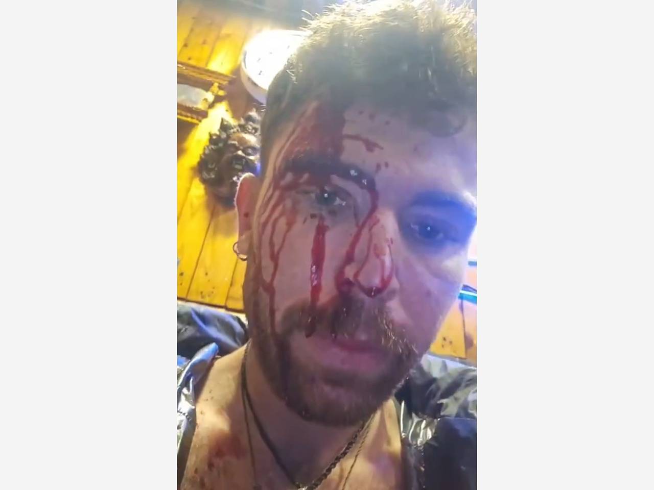 Туриста ударили по голове металлической дубинкой в Непале из-за национальности