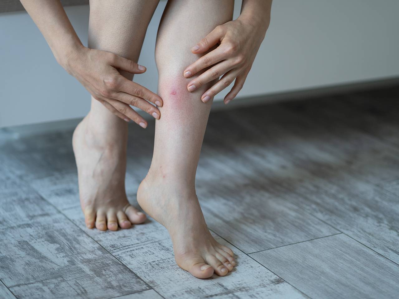 Российских туристов атаковали клопы в элитных отелях ОАЭ